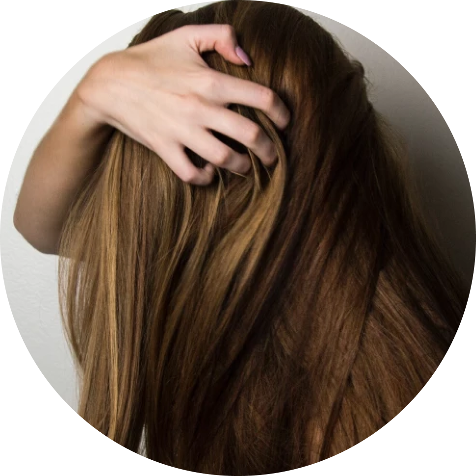 Дайджест: выпадение волос и как его остановить (фото 5)