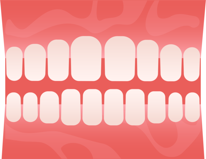 Люминиры, виниры и элайнеры. Почему важно следить за своим прикусом (фото 16)