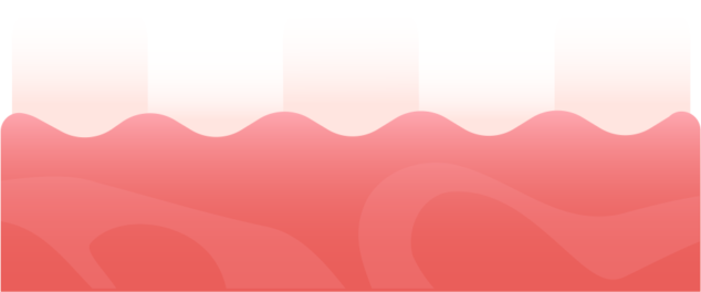 Люминиры, виниры и элайнеры. Почему важно следить за своим прикусом (фото 24)