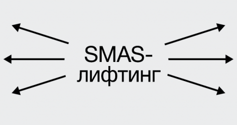 С натяжкой: как работает SMAS-лифтинг и нужен ли он вам